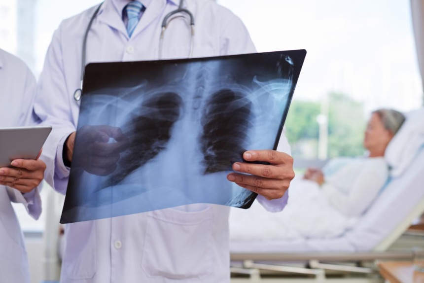 Bệnh viêm phổi cấp là căn bệnh vô cùng nguy hiểm