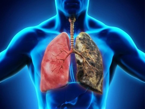 Thuốc điều trị viêm phổi cấp dùng loại nào?